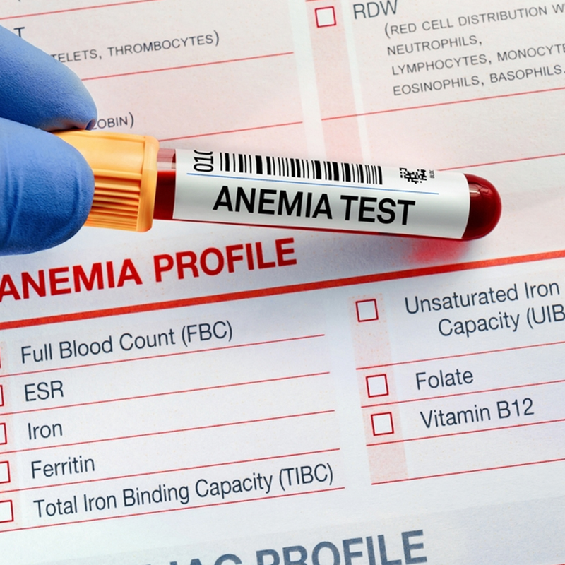 Anemia Profile